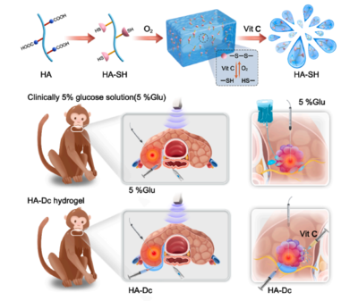 任杰与刘杰教授团队研发多功能水凝胶，为热消融治疗带来生物基材料新突破